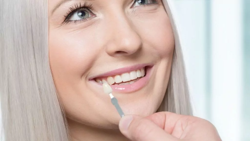 Smiling Woman With Dental Veneer Sample