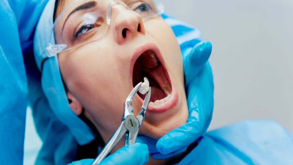 Close-up Of Wisdom Tooth Extraction