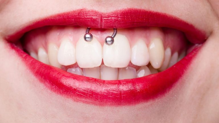 Oral Piercings and the Long-Term Impact on Your Smile